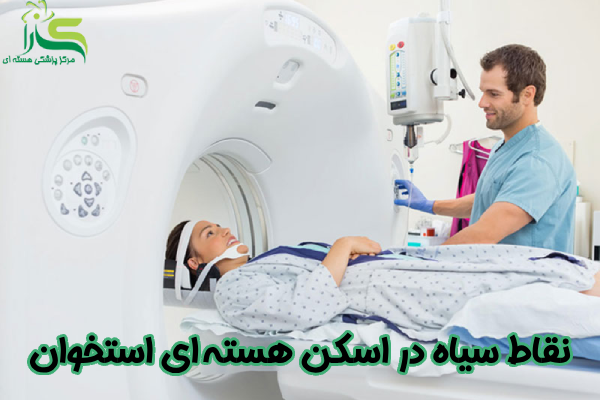 نقاط سیاه در اسکن هسته ای استخوان