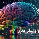 اسکن مغزی