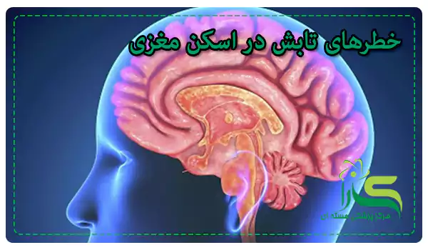 خطرهای تابش در اسکن مغزی