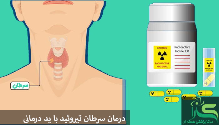 درمان سرطان با ید درمانی