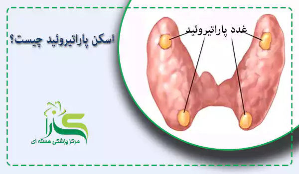 اسکن پاراتیروئید چیست؟