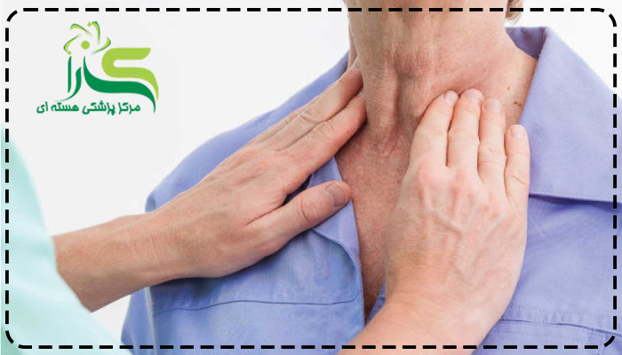 عوارض ید رادیواکتیو برای اطرافیان