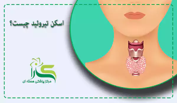 اسکن هسته ای تیروئید چیست؟