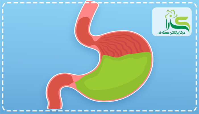 مزایای اسکن تخلیه معده