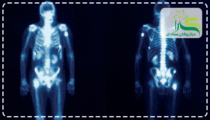 انواع رادیو دارو