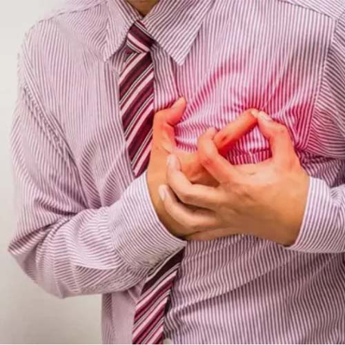 ماذا تعرف حول النوبة القلبية؟