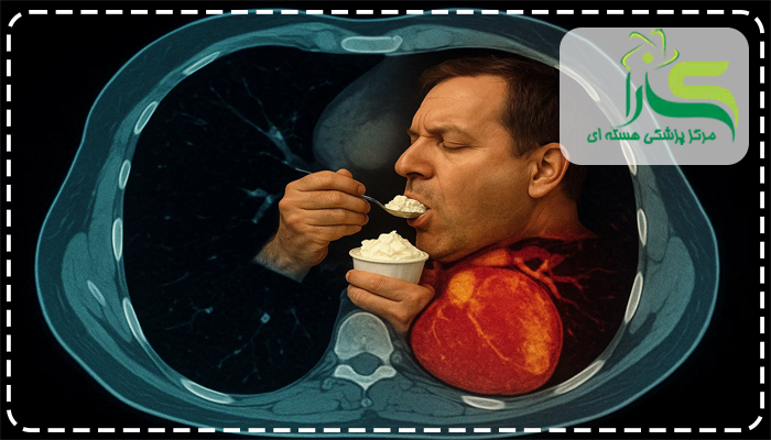 علت خوردن خامه قبل از اسکن قلب